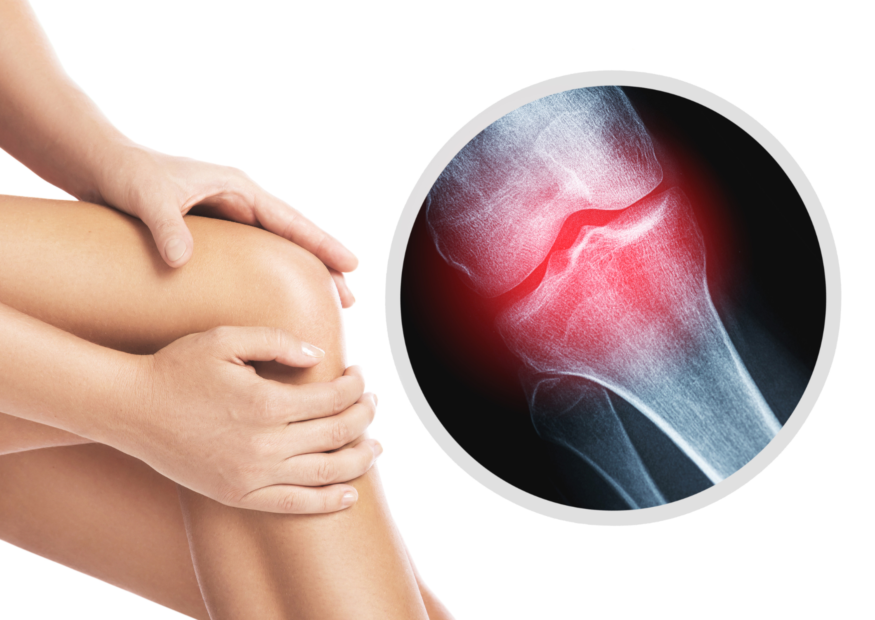 Can Red Light Therapy Help Strengthen Bones?